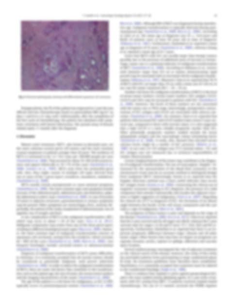 Solution An Ovarian Mature Cystic Teratoma Evolving In Squamous Cell