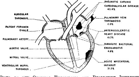 Figure 1 From Peripheral Arterial Embolism Semantic Scholar