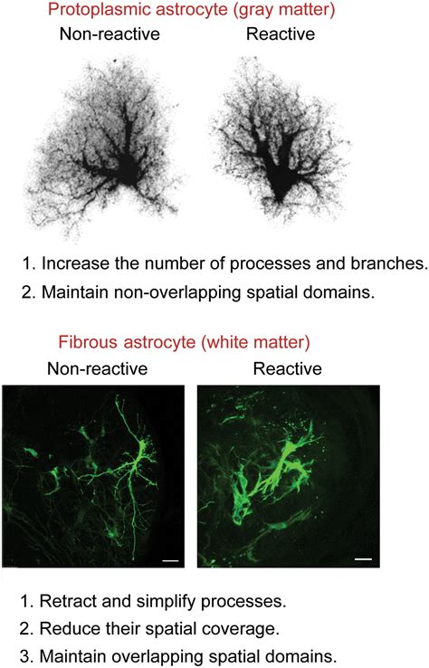 Protoplasmic Astrocytes