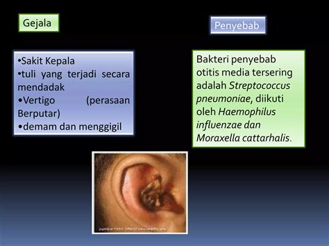 Infeksi Saluran Pernapasan Akut Ispa Ppt