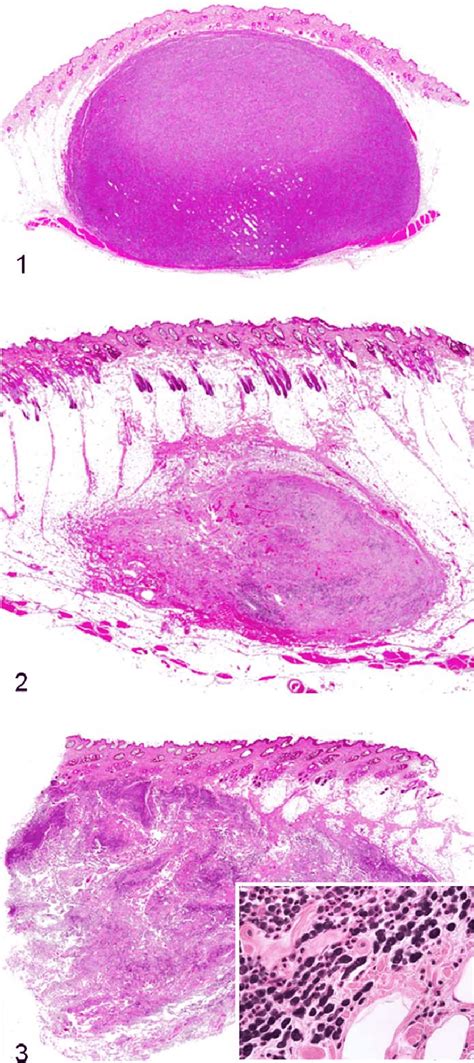 Subcutaneous Mast Cell Tumor Canine Circumscribed Histologic Pattern