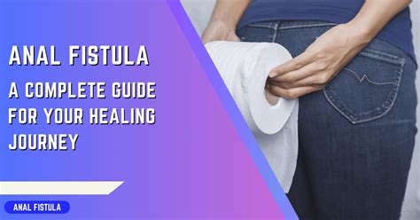 Causes Of Anal Fistula Complete Guide For Prevention Care