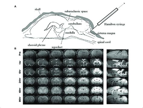 Intrathecal Injection Mouse