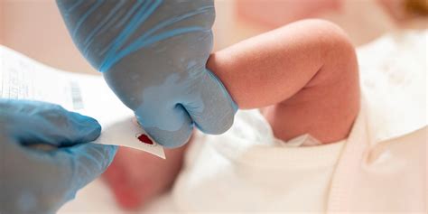 Screening Neonatale Per La SMA A Cosa Serve GravidanzaOnLine