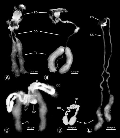 Gross Morphology Of The Male Reproductive System In Various Pholcid Download Scientific Diagram