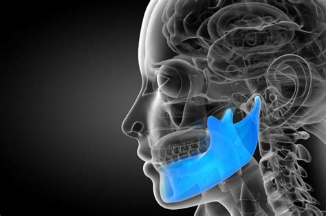 Tmj Fracture Treatment Jaw Fracture Temporomandibular Joint Fracture
