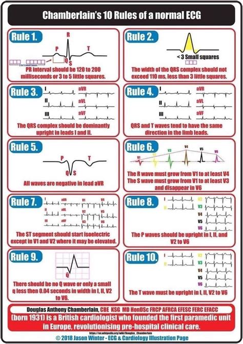 Free Printable Ekg Interpretation Cheat Sheet Printable Word Searches