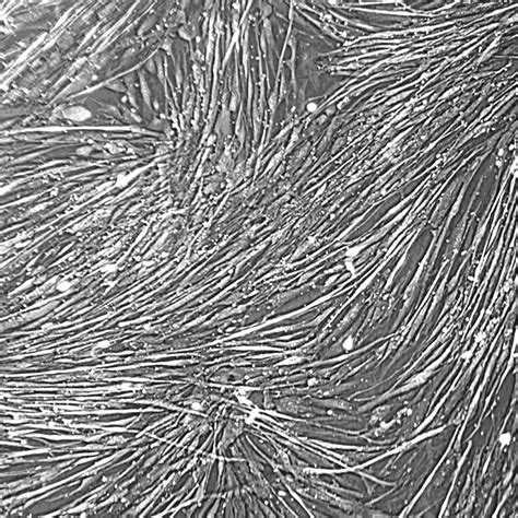Human Skeletal Muscle Satellite Cells