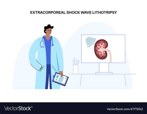 Lithotripsy procedure concept Royalty Free Vector Image