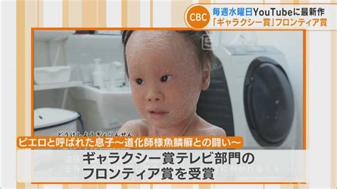 ドキュメンタリーの新しい視聴方法 評価される Cbcテレビ「ピエロと呼ばれた息子」がギャラクシー賞フロンティア賞受賞 Tbs News Dig 1ページ