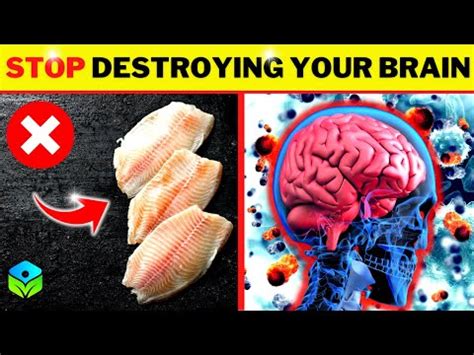 STOP Eating Foods That Destroy Your Brain Brain Health YouTube