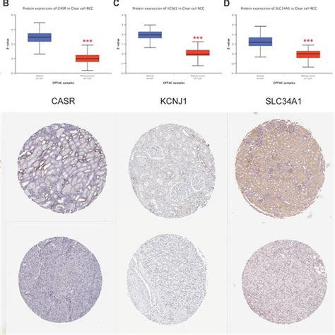 Protein Expression Levels Of Hub Genes In Ccrcc Ae Show The Results