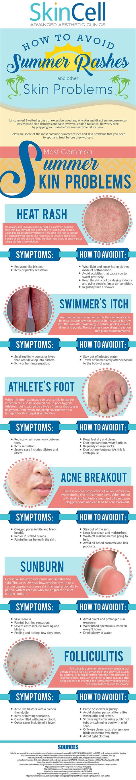 How To Avoid Summer Rashes And Other Skin Problems Infographic