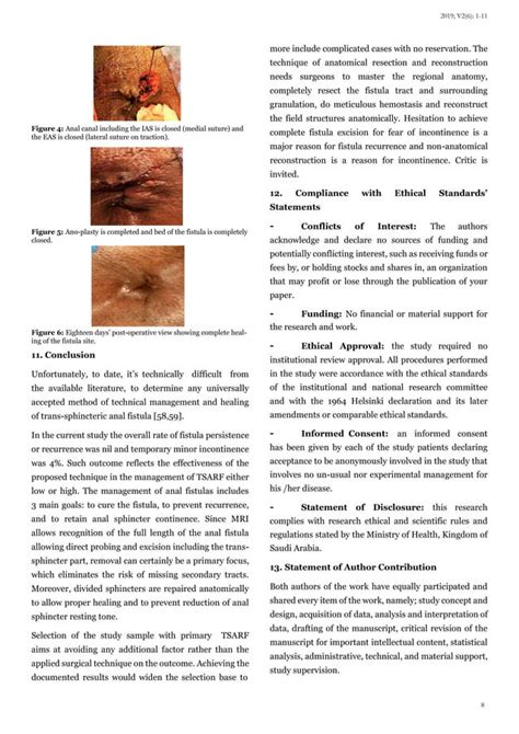 Combined Single Surgical Cession Anatomical Trans Sphinc Ter Anal Fistulectomy And Ano Plasty