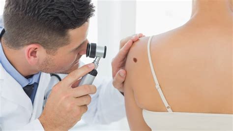 Skin Cancers What You Need To Know Zel Skin And Laser Specialists