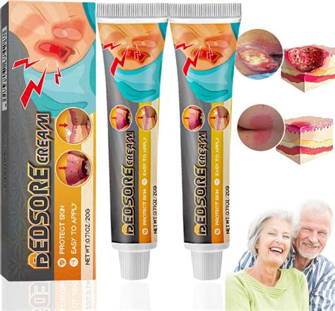 Pcs Bed Sore Cream Bedsore Treatment Healing Ointment Bed Sore Wound