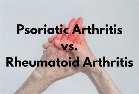 Psoriatic Arthritis vs. Rheumatoid Arthritis | Dr Badhan : FirstChoice