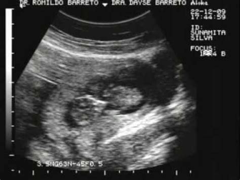 Bebe 3 Meses Na Barriga - Meu bebe na barriga da mamae com 3 meses de vida! - YouTube