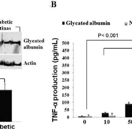 Accumulation Of Glycated Albumin In Diabetic Retina And Its