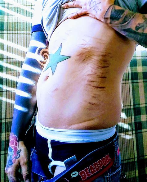 Months Today Fuck Yeah R Selfharmscars