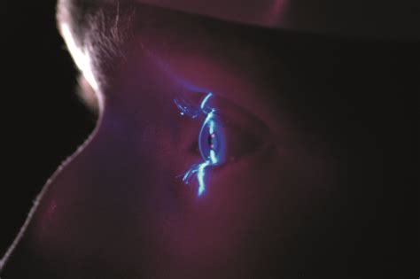 The Advanced Technology that Transformed My Myopia Management Practice