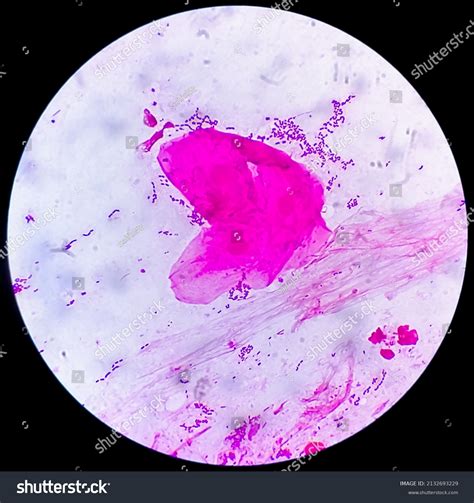 Diplococci