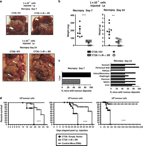 Targeting Colon Cancer Cell Nf B Reduces Peritoneal Metastasis A