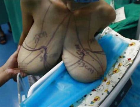 Macromastia Porn Pictures Xxx Photos Sex Images Pictoa