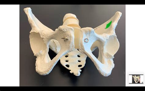 Solved Victim A ACTIVITY I SEX DETERMINATION FROM PELVIC MORPHOLOGY Course Hero
