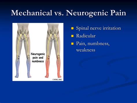 PPT Nonsurgical Management Of Acute And Chronic Back Pain PowerPoint