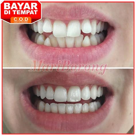 arti mimpi gigi atas copot 2 buah 8