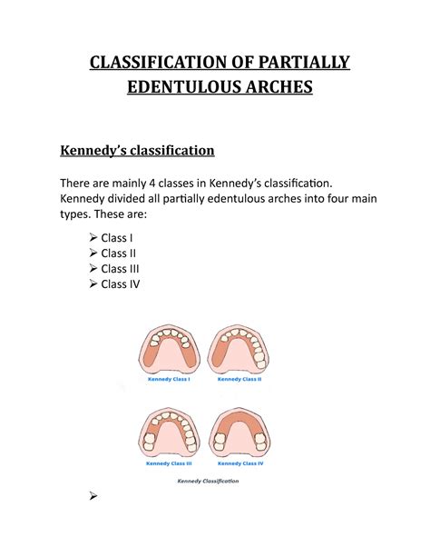 Kennedys Classification Kennedy Divided All Partially Edentulous Arches Into Four Main Types