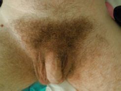 Extrem Hairy Body Porn Pictures Xxx Photos Sex Images Pictoa