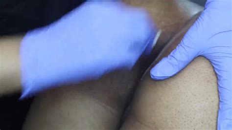 Anal Bleaching Nude Video On YouTube Nudeleted