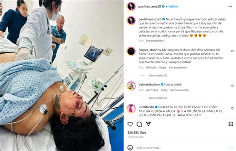 Paola Suárez Twitter video Qué le pasó a la integrante de Las