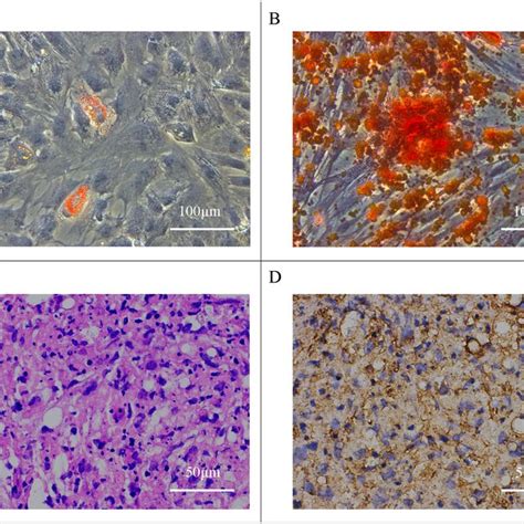 Multipotent Differentiation Of Hascs In Vitro A Oil Red O Staining