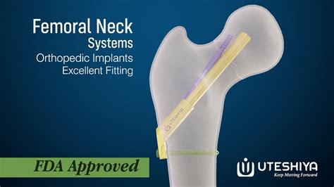 Uteshiya Medicare Femoral Neck System Youtube