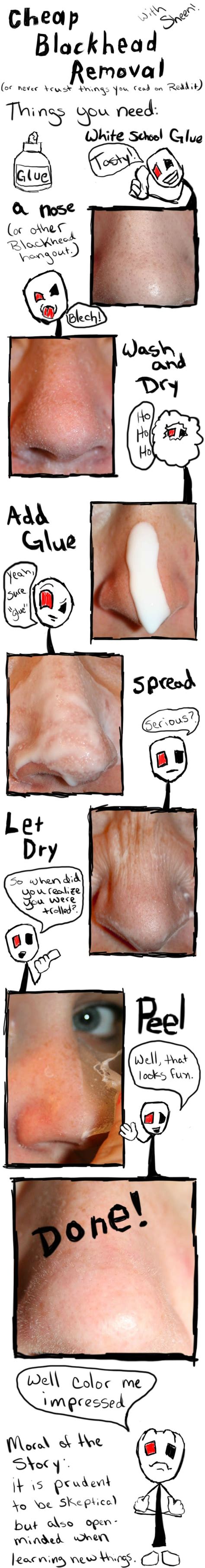 Cheap Blackhead Removal School Glue Imgur