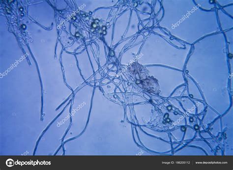 Water Mold Microscope