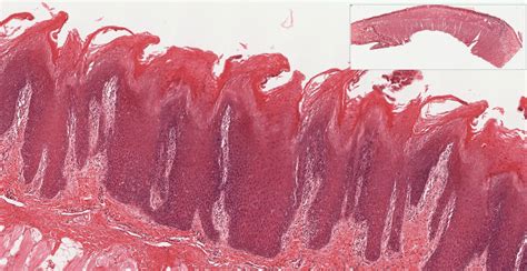 Oral Cavity Pharynx Esophagus And Stomach Histology