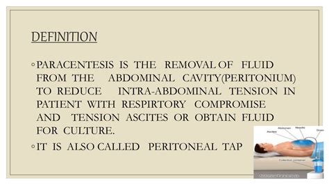Paracentesis