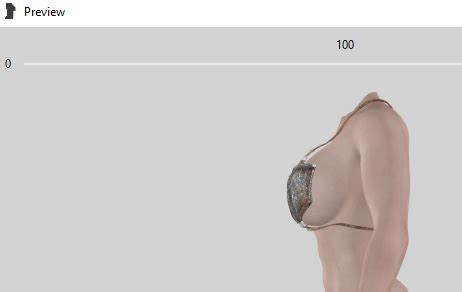 The Amazing World Of Bikini Armor Remastered Bikini Top Issue Technical Support Skyrim