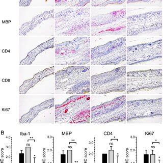 NTCI Treatment Reduces Signs Of MC903 Induced Atopic Dermatitis