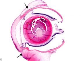 Eye, Conjunctiva - Edema - Nonneoplastic Lesion Atlas