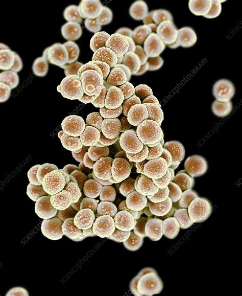 MRSA Bacteria SEM Stock Image C026 7470 Science Photo Library