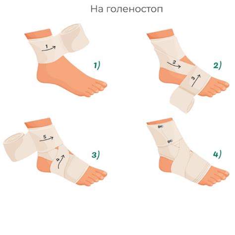 Для чого потрібен еластичний бинт? | Med-magazin.ua - мережа магазинів ...