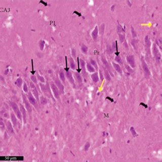 Photomicrograph of the CA1, CA3, and DG regions of the hippocampus of a ...