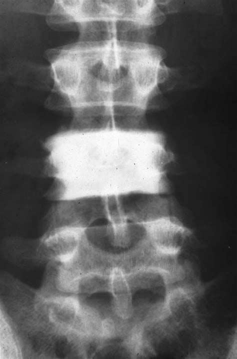 Pin By Kathy I On Radiology Radiology X Ray Bone Diseases