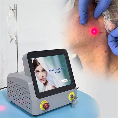 Endolaser Lipolysis Facial Slimming Skinlift Double Chin Laser Machine