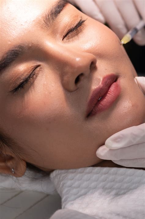 Dermal Fillers Pros And Cons